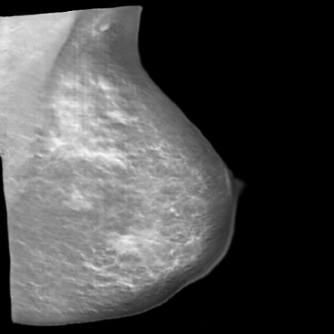Generated Calcification Image